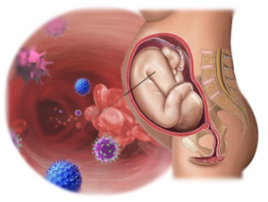 Цитомегаловирус и беременность